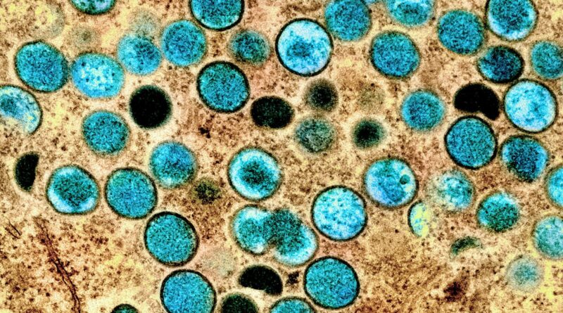 Individuato nel Regno Unito il quinto caso di ceppo di mpox